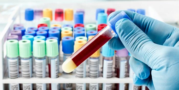 Платні та безкоштовні лабораторії: де здати аналіз